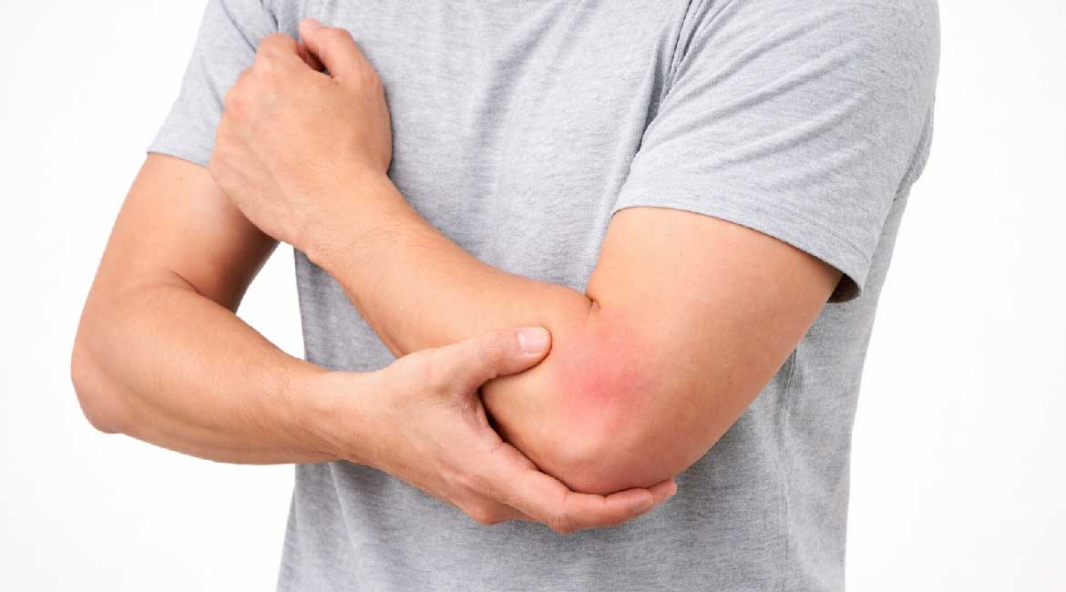 Šta je sindrom lacertusa? Prepoznajte simptome i uzroke